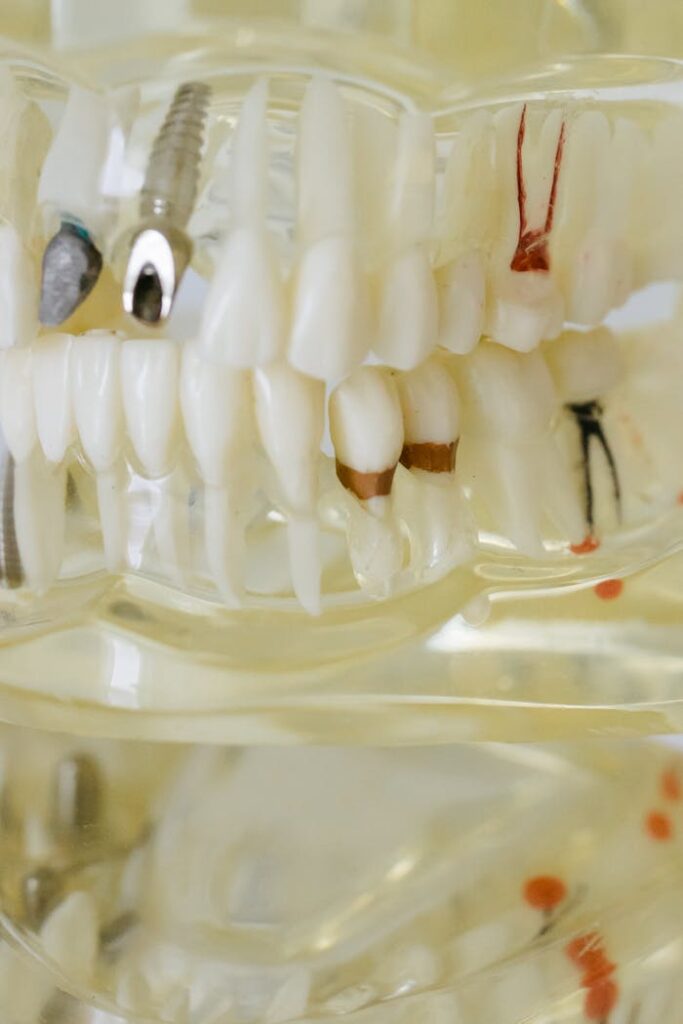 pexels-photo-6502345 Disease Dental Teeth Model in Close Up Photography